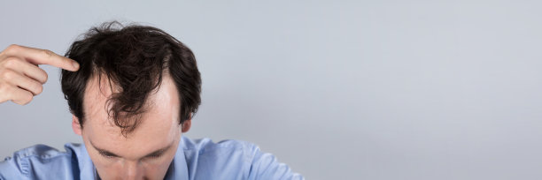 有脱发症状的男子图片下载