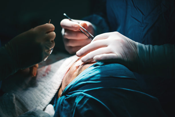 整形外科医生在手术室做鼻整形手术时缝针。图片下载