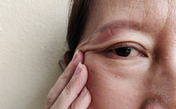 松弛的皱纹下垂在眼皮旁边，脸上的雀斑和瑕疵。图片下载