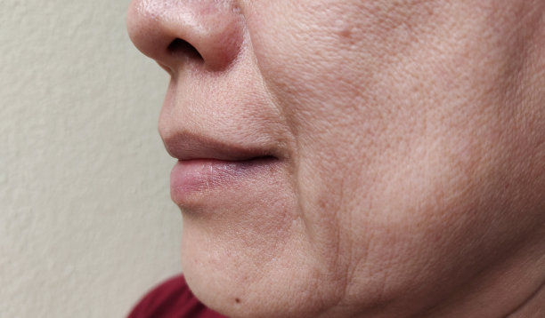 嘴角边松弛的脂肪下垂的皮肤，皱纹和微笑纹的松弛。图片下载