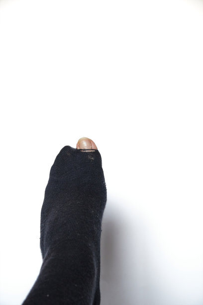 袜子上露出脚趾的洞图片下载