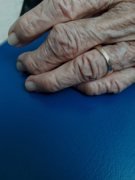 类风湿性关节炎图片下载