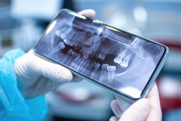 牙科医生双手戴着防护手套，拿着手机，展示病人的x光片。图片下载