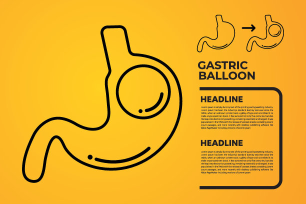 胃内窥镜胃内球囊减重手术载体插图肥胖图片下载