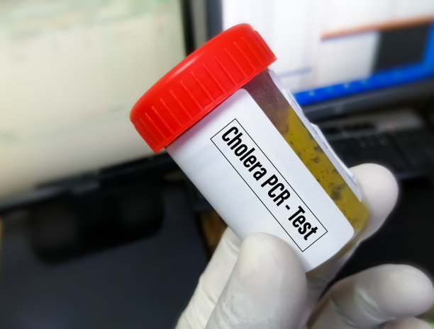 霍乱弧菌PCR检测，用于诊断霍乱疾病（一种急性腹泻疾病）图片下载