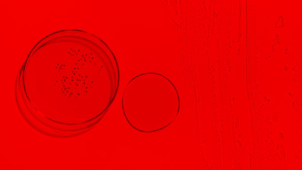 培养皿，血液，红色，实验室，实验室仪器，包裹体，液体，凝胶，血浆，液体图片下载