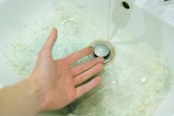 男人的手在肮脏的白色洗涤槽上露出来，上面有小头发。手脸盆。公众。关系。卫生。卫生学。消毒流行病学绝育手术。公共卫生。卫生设施。私人图片下载