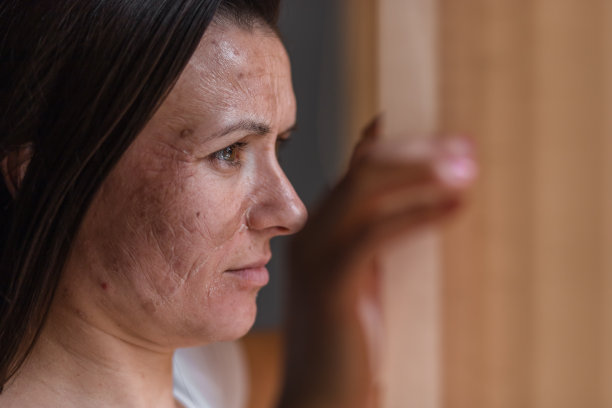 皮肤干燥的女人往窗户里看的照片。图片下载