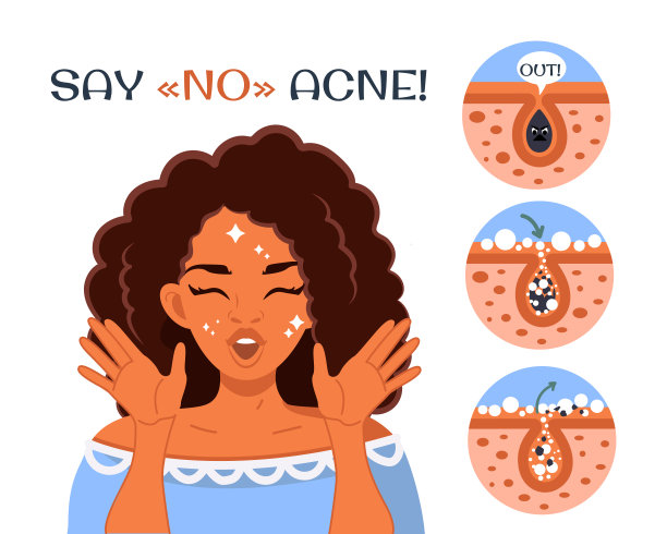 对痘痘说不!一个年轻快乐的非裔美国女性拥有完美的皮肤图片下载