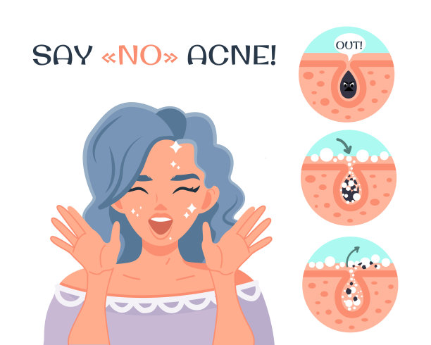 对痘痘说不!一个年轻快乐的女孩拥有完美的皮肤图片下载