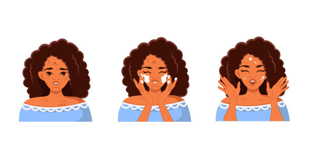 治疗痤疮。一位年轻的非裔美国妇女正在清洗和清洁她的皮肤图片下载