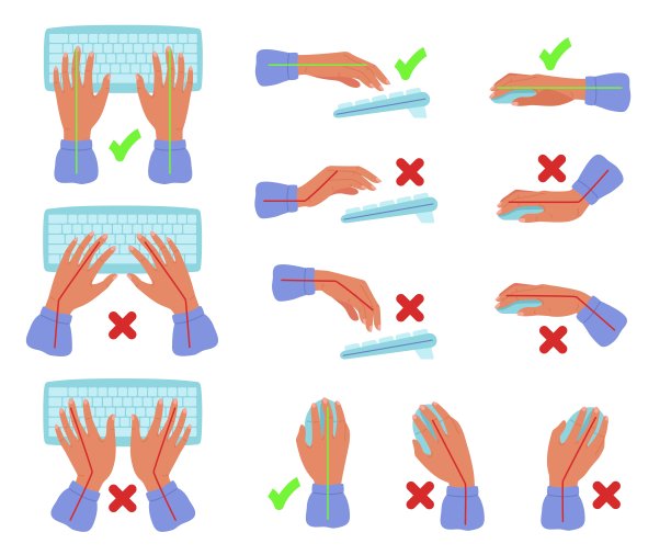 键盘和鼠标的手姿势。正确和不正确的手的位置为文本打字，手腕和手臂的位置为计算机用户矢量插图集图片下载