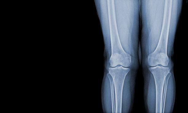 人体双膝站立x光片，观察正常关节和韧带。图片下载