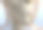下巴缩小术(骨型成形术)。医学上精确的牙科3D插图。图片下载