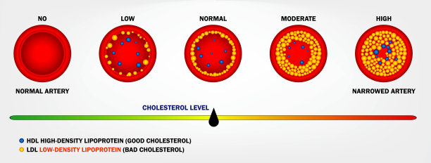 动脉中分离出的实际胆固醇类型。每股收益向量图片下载