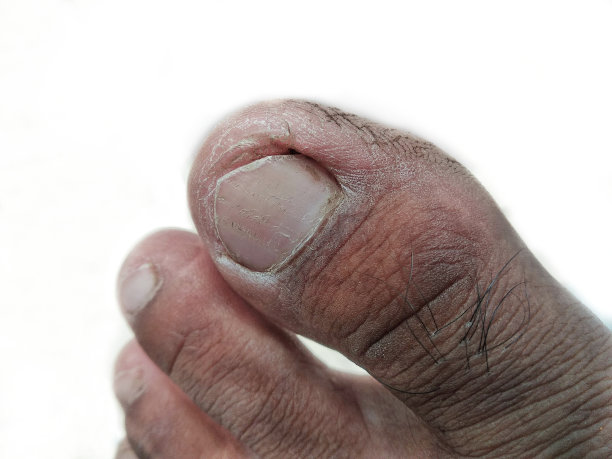 特写脚趾，脚的手指孤立在白色背景图片下载