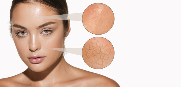 女性皮肤问题特写。美丽的黑发女人和面部疾病:痤疮，黑头，干燥，油，皱纹。白色背景。护肤、保健、美容、养生、衰老过程图片下载