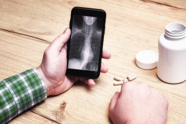 一名男子拿着有他胸部x光照片的手机，在寻找药片图片下载