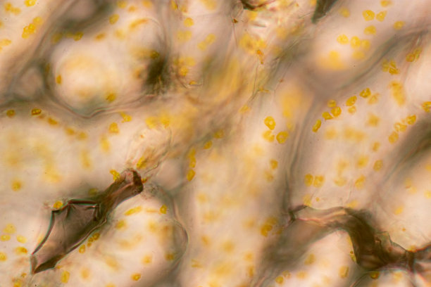 课堂教学用显微镜下植物细胞的染色体显示。图片下载