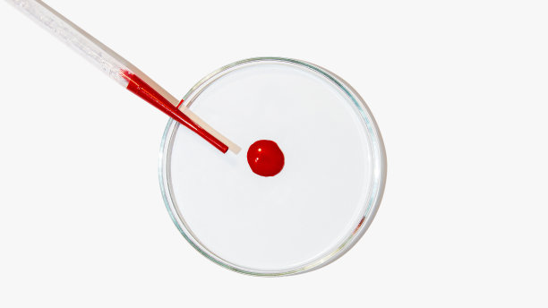 在浅色背景上的培养皿。一滴血。化验，dna，验血，化验。图片下载