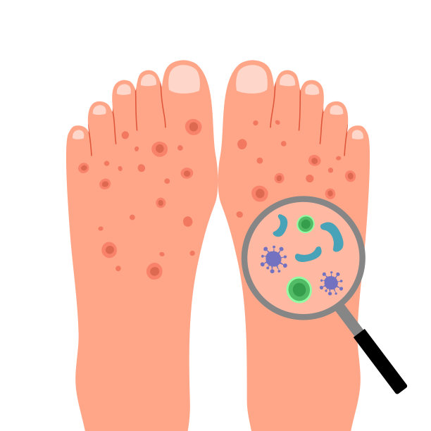 白底平纹足部皮肤真菌感染。图片下载