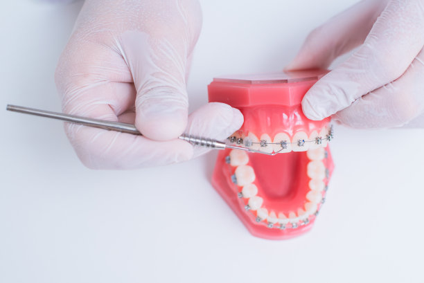 正畸医生展示牙齿上的牙套系统是如何排列的图片下载