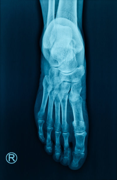 人体足部及足部x光影像图片下载