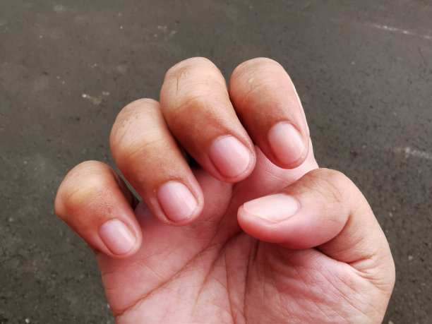 男人的手指上有新剪的指甲。图片下载