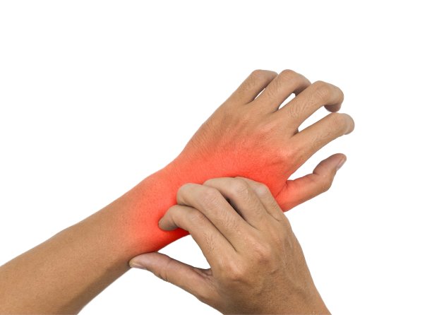 亚洲人挠手。瘙痒性皮肤病的概念，如疥疮、真菌感染、湿疹、牛皮癣、过敏等。图片下载