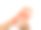 亚洲人挠手。瘙痒性皮肤病的概念，如疥疮、真菌感染、湿疹、牛皮癣、过敏等。图片下载