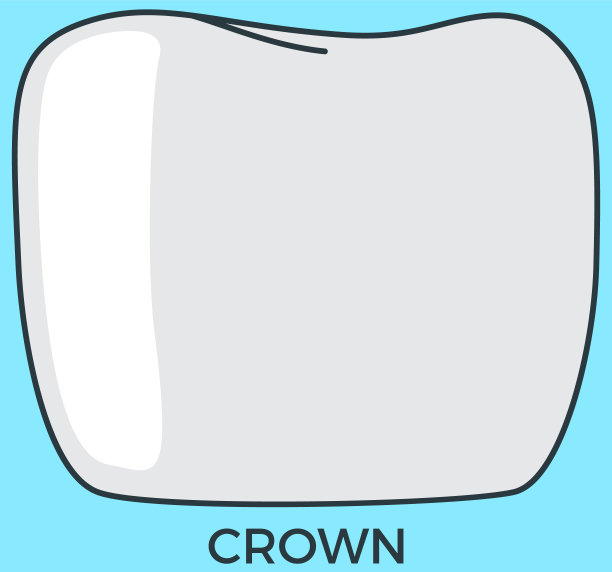 金属陶瓷固定假体。模拟牙齿解剖形状的牙冠，植牙图片下载