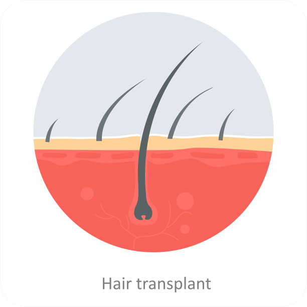 头发移植图片下载