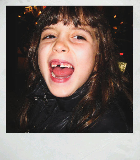 小女孩露出缺牙的画像。即时打印照片图片下载