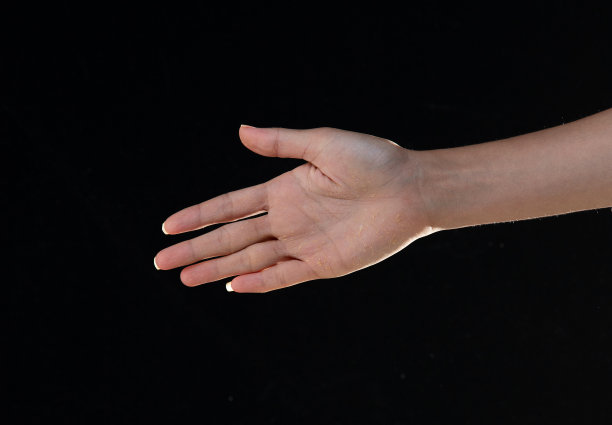 手干燥，手和手指皮肤脱皮。空气过敏，化学过敏，皮炎，湿疹。闭合皮肤干燥的女性的手指、手掌。医学与卫生保健概念。黑色背景隔离图片下载