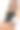 美容。美女在美容院接受激光脱毛手术。美容师在水疗沙龙为女性手臂做美容。防护眼镜图片下载