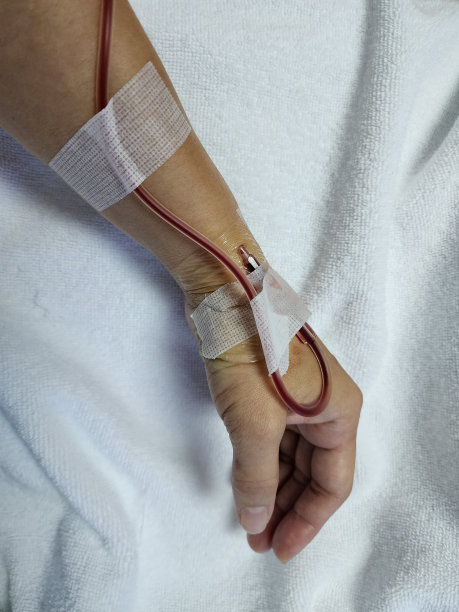 身体的部分部位，手，手臂都注射了生理盐水。当生理盐水用完或生理盐水袋在手臂以下时图片下载