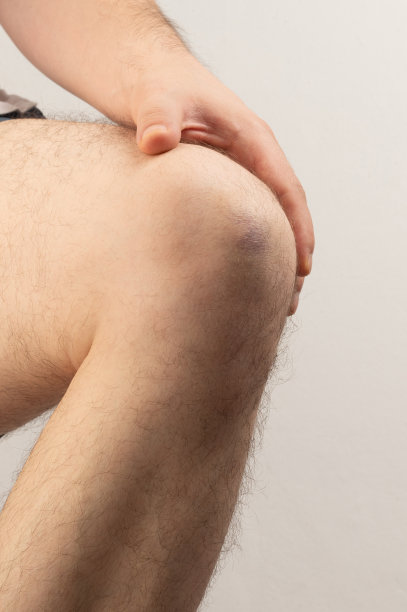 受伤的膝盖近景图片下载