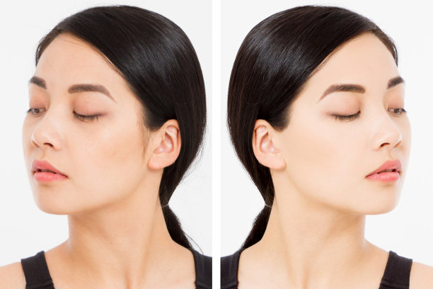 亚洲女子整容手术前的笑脸特写。皮肤护理皱纹脸，黑眼圈。前后抗衰老整容治疗。面部护肤，美容修身图片下载