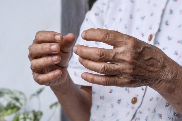 亚洲老妇人的手。类风湿性关节炎、骨关节炎或关节疼痛的概念。手的弱点。图片下载