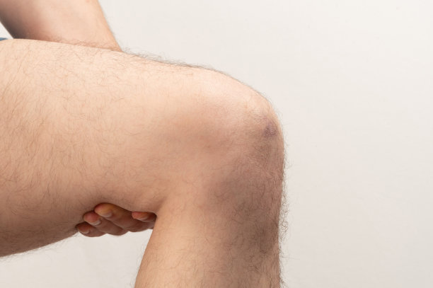 膝盖治疗主题图片下载