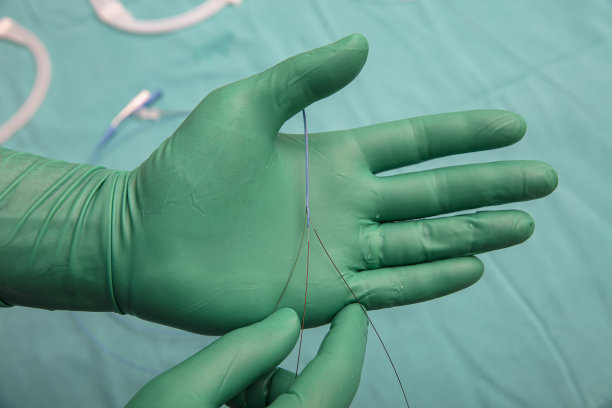 冠状动脉成像导管。双腔导管。冠状动脉造影显示微导管导丝。图片下载