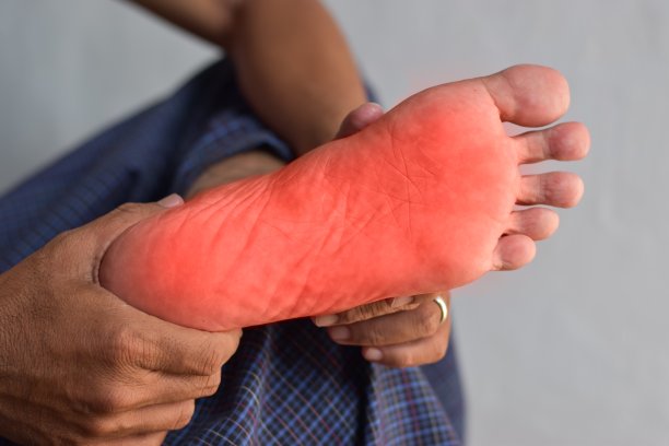 亚洲男子脚部有刺痛和烧灼感。脚痛。感觉神经病变问题。足底筋膜炎。皮肤瘙痒。图片下载