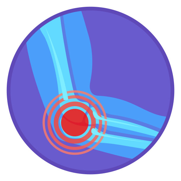 肘关节疼痛圆形图示。医疗插图图片下载