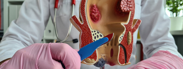 医生正拿着手术刀解剖直肠问题图片下载