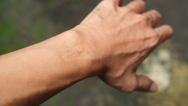 针的伤疤图片下载