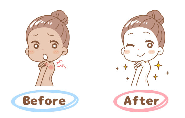 设定晒伤前后，上身的插图。图片下载