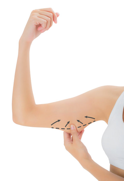 女子抓皮肤在她的上臂与绘制黑色箭头，减肥和抽脂去除脂肪团的概念，隔离在白色背景。图片下载