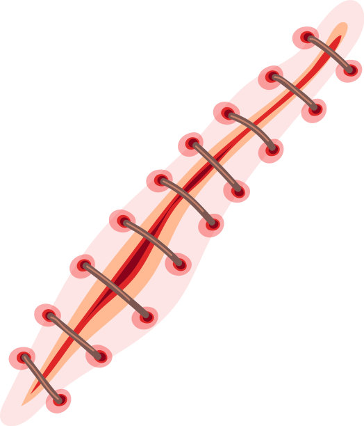 缝合的伤口，撕裂的皮肤，血淋淋的伤疤图片下载