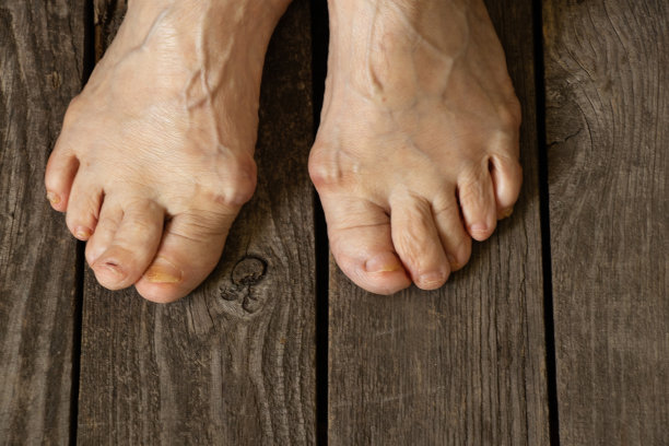 老祖母的脚在她房间的地板上图片下载