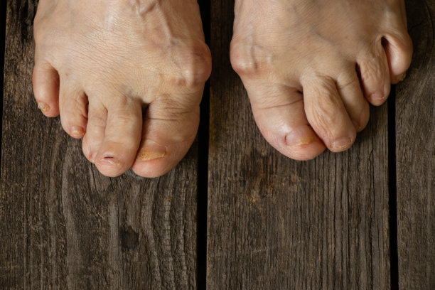 老祖母的脚在她房间的地板上图片下载